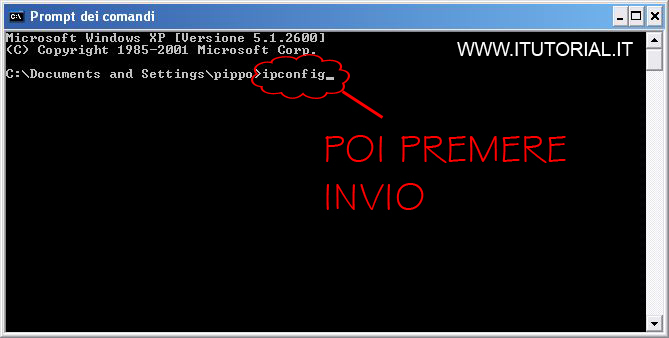 ipconfig 1